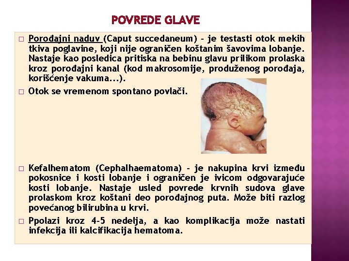 POVREDE GLAVE � � Porođajni naduv (Caput succedaneum) - je testasti otok mekih tkiva