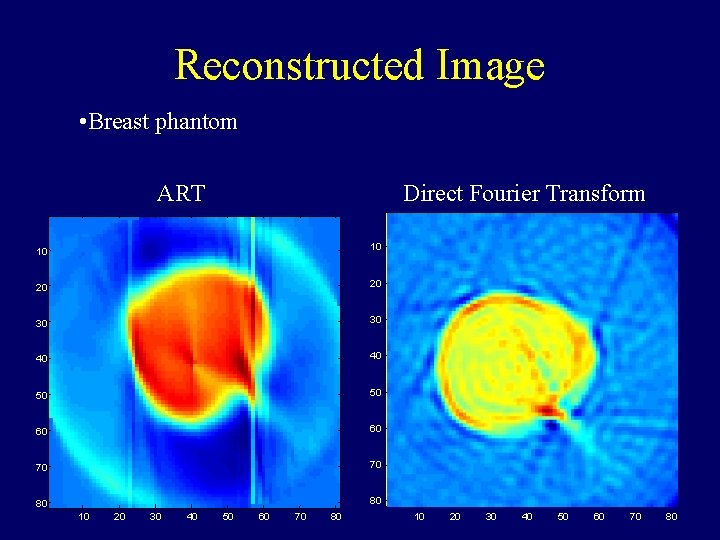 Reconstructed Image • Breast phantom ART Direct Fourier Transform 10 10 20 20 30