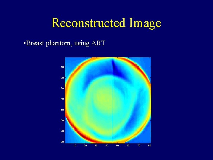 Reconstructed Image • Breast phantom, using ART 10 20 30 40 50 60 70