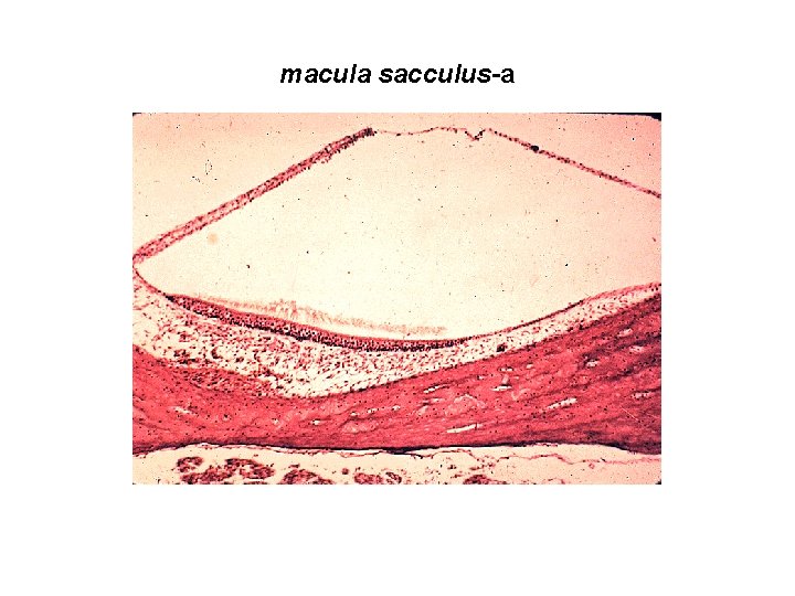 macula sacculus-a 