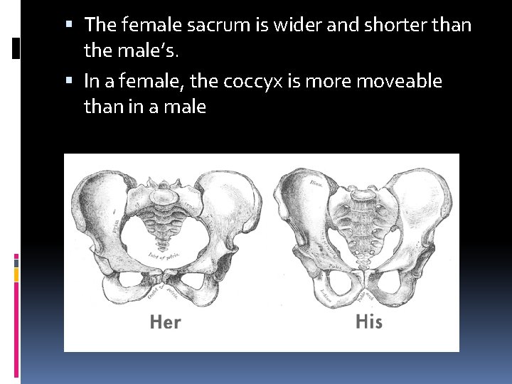  The female sacrum is wider and shorter than the male’s. In a female,
