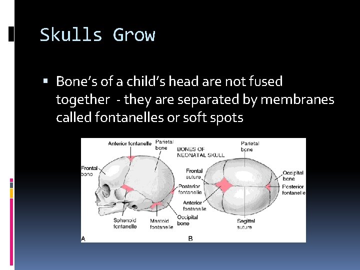 Skulls Grow Bone’s of a child’s head are not fused together - they are