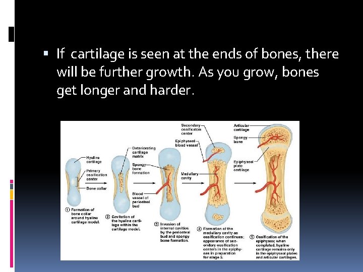  If cartilage is seen at the ends of bones, there will be further