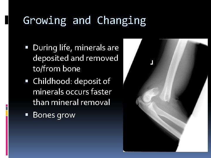 Growing and Changing During life, minerals are deposited and removed to/from bone Childhood: deposit