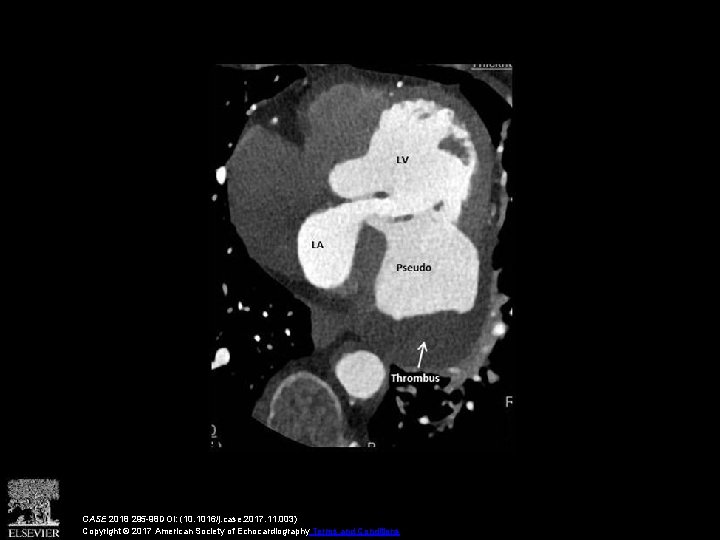 CASE 2018 295 -98 DOI: (10. 1016/j. case. 2017. 11. 003) Copyright © 2017