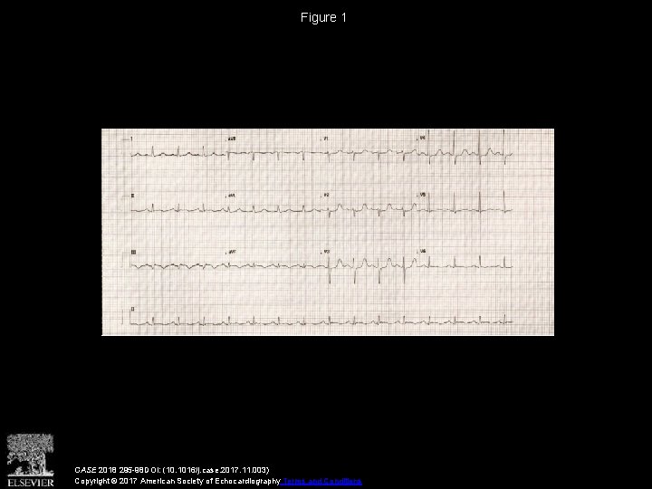 Figure 1 CASE 2018 295 -98 DOI: (10. 1016/j. case. 2017. 11. 003) Copyright