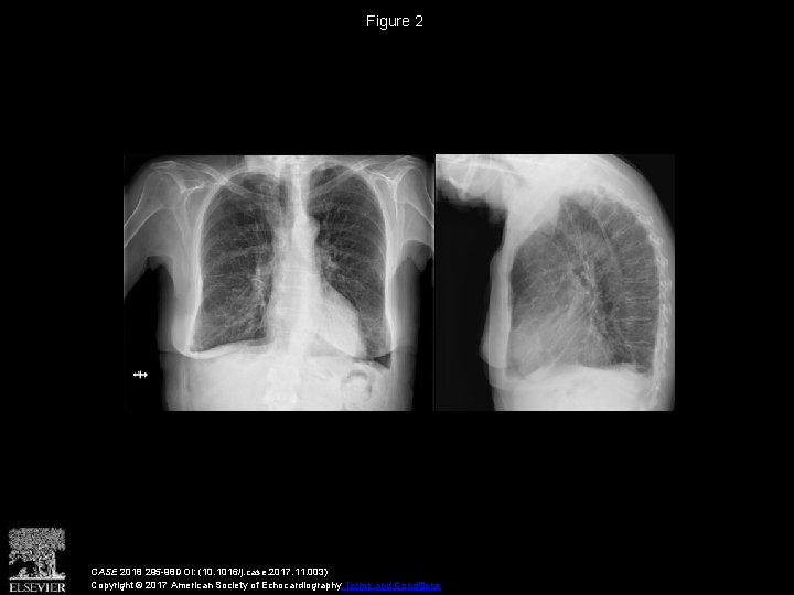 Figure 2 CASE 2018 295 -98 DOI: (10. 1016/j. case. 2017. 11. 003) Copyright