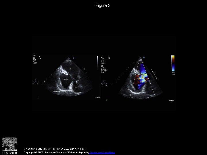 Figure 3 CASE 2018 295 -98 DOI: (10. 1016/j. case. 2017. 11. 003) Copyright