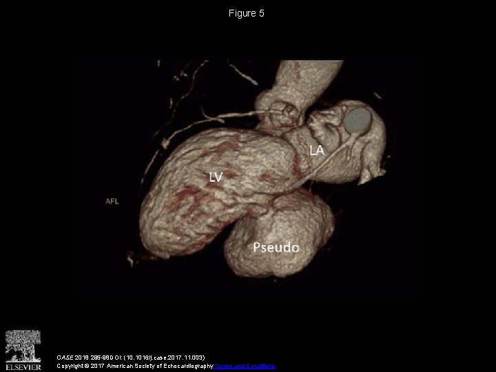 Figure 5 CASE 2018 295 -98 DOI: (10. 1016/j. case. 2017. 11. 003) Copyright