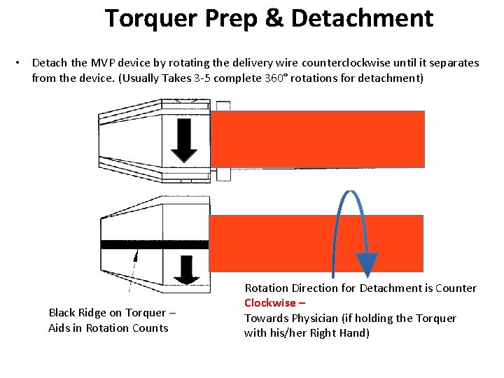 Torquer Prep & Detachment • Detach the MVP device by rotating the delivery wire