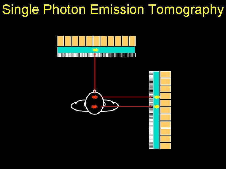 Single Photon Emission Tomography 