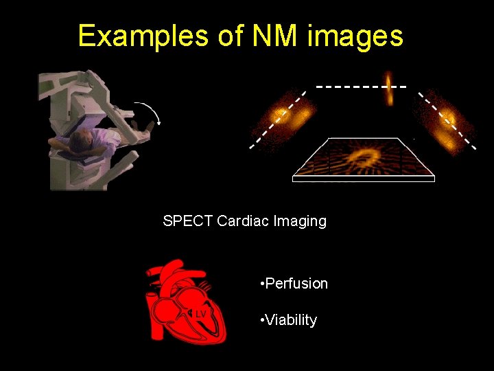 Examples of NM images SPECT Cardiac Imaging • Perfusion • Viability 