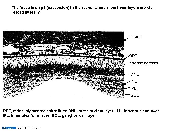 The fovea is an pit (excavation) in the retina, wherein the inner layers are
