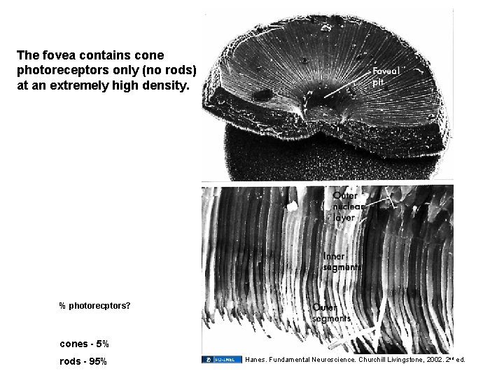 The fovea contains cone photoreceptors only (no rods) at an extremely high density. %