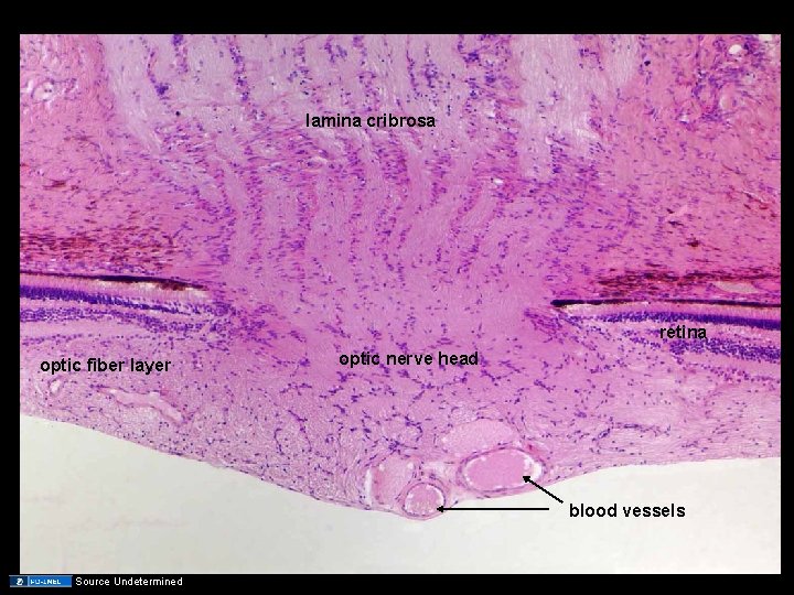 lamina cribrosa retina optic fiber layer optic nerve head blood vessels Source Undetermined 