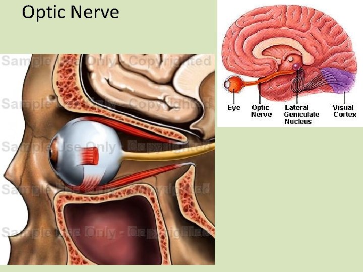 Optic Nerve 