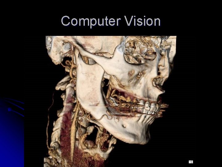 Computer Vision 