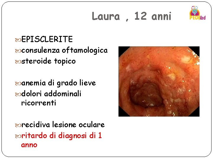 Laura , 12 anni EPISCLERITE consulenza oftamologica steroide topico anemia di grado lieve dolori