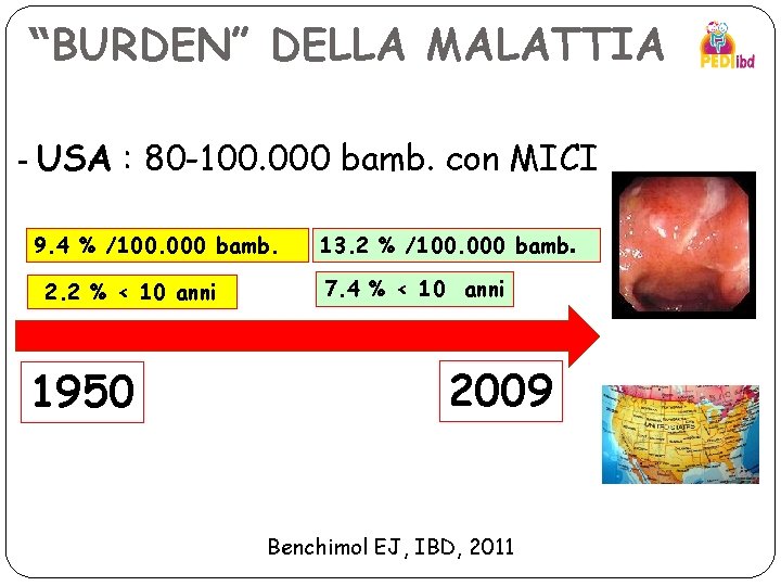 “BURDEN” DELLA MALATTIA - USA : 80 -100. 000 bamb. con MICI 9. 4