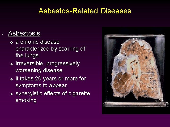 Asbestos-Related Diseases • Asbestosis: v v a chronic disease characterized by scarring of the