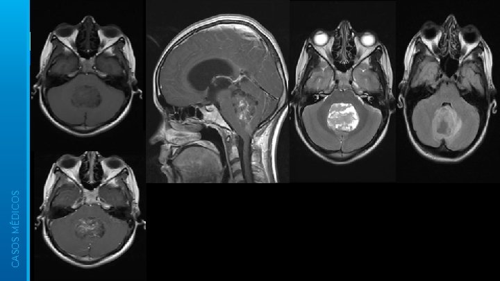 CASOS MÉDICOS 