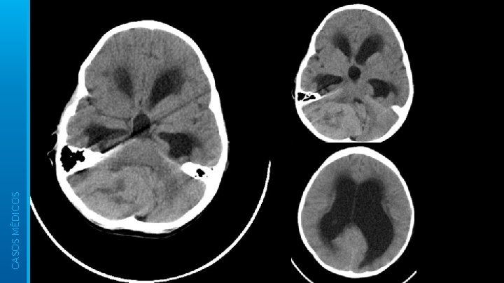 CASOS MÉDICOS 