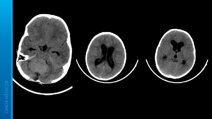 CASOS MÉDICOS 