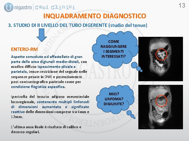 13 INQUADRAMENTO DIAGNOSTICO 3. STUDIO DI II LIVELLO DEL TUBO DIGERENTE (studio del tenue)