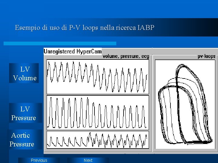 Esempio di uso di P-V loops nella ricerca IABP LV Volume LV Pressure Aortic Esempio di uso di P-V loops nella ricerca IABP LV Volume LV Pressure Aortic