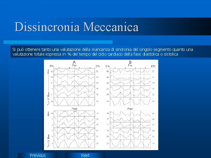 Dissincronia Meccanica Si può ottenere tanto una valutazione della mancanza di sincronia del singolo Dissincronia Meccanica Si può ottenere tanto una valutazione della mancanza di sincronia del singolo
