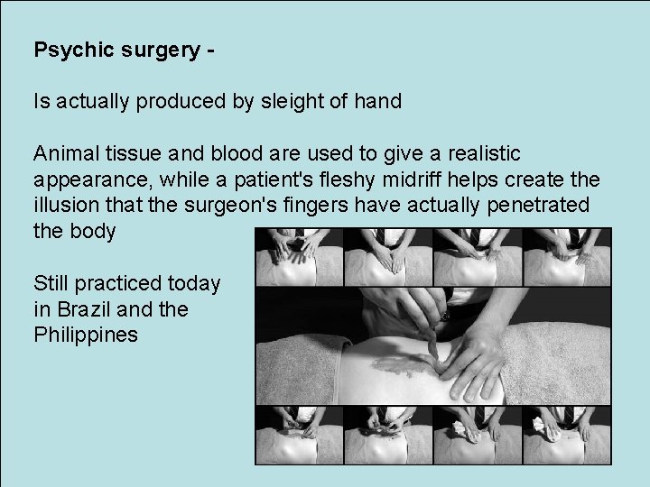 Psychic surgery Is actually produced by sleight of hand Animal tissue and blood are