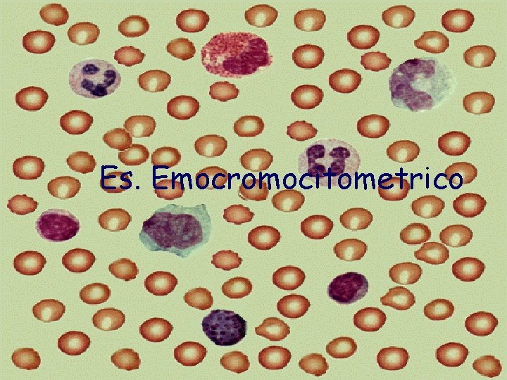 Es. Emocromocitometrico 