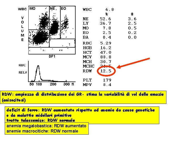 RDW: ampiezza di distribuzione dei GR- stima la variabilità di vol delle emazie (anisocitosi)