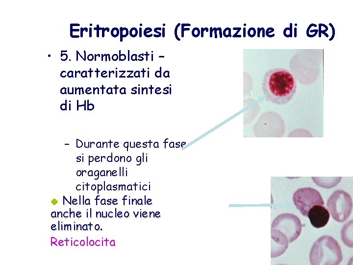 Eritropoiesi (Formazione di GR) • 5. Normoblasti – caratterizzati da aumentata sintesi di Hb