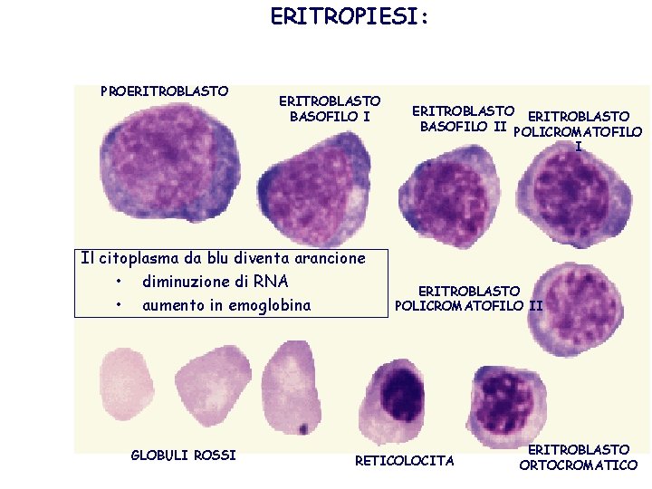 ERITROPIESI: Tempo di produzione – 5 giorni PROERITROBLASTO BASOFILO II POLICROMATOFILO I Il citoplasma