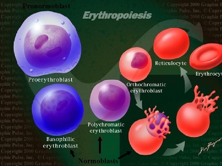 Pronormoblast Normoblasts 