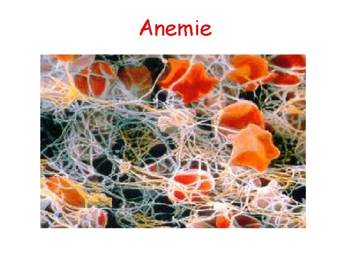 Anemie 