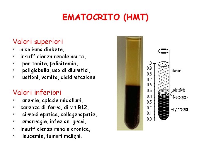 EMATOCRITO (HMT) Valori superiori • • • alcolismo diabete, insufficienza renale acuta, peritonite, policitemia,