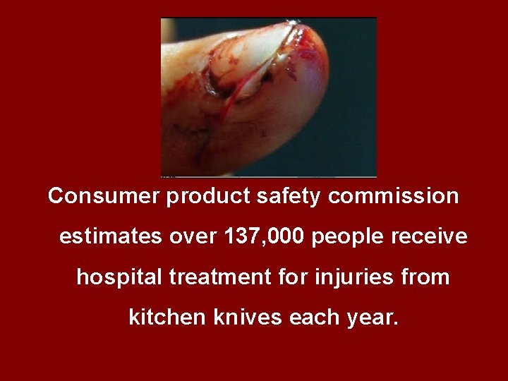 Consumer product safety commission estimates over 137, 000 people receive hospital treatment for injuries