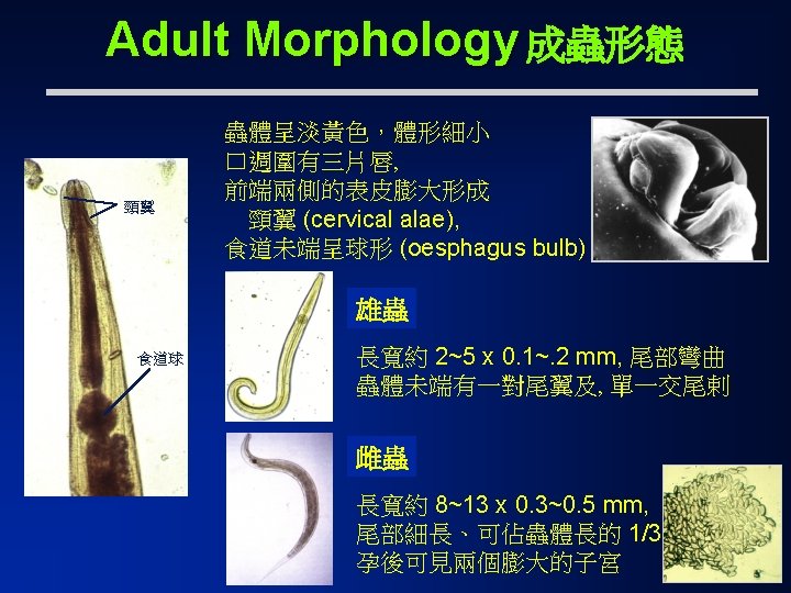 Enterobius vermicularis Also known as pinworm or threadworm