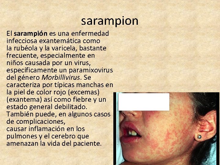 sarampion El sarampión es una enfermedad infecciosa exantemática como la rubéola y la varicela,