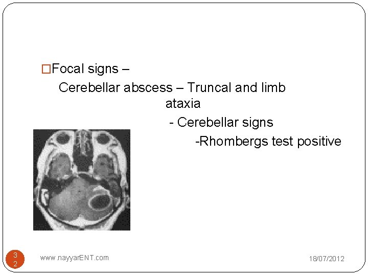 �Focal signs – Cerebellar abscess – Truncal and limb ataxia - Cerebellar signs -Rhombergs