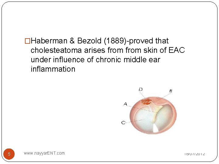 �Haberman & Bezold (1889)-proved that cholesteatoma arises from skin of EAC under influence of