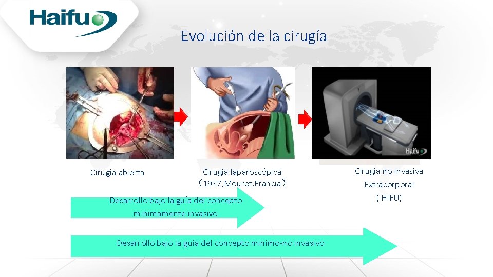 Evolución de la cirugía Cirugía abierta Cirugía laparoscópica （1987, Mouret, Francia） Desarrollo bajo la