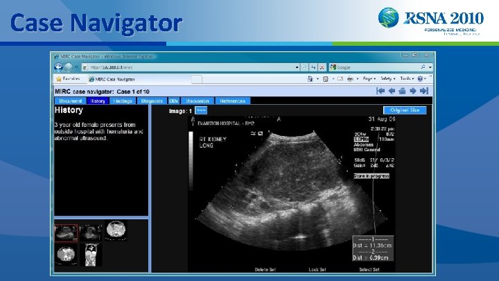 Case Navigator 