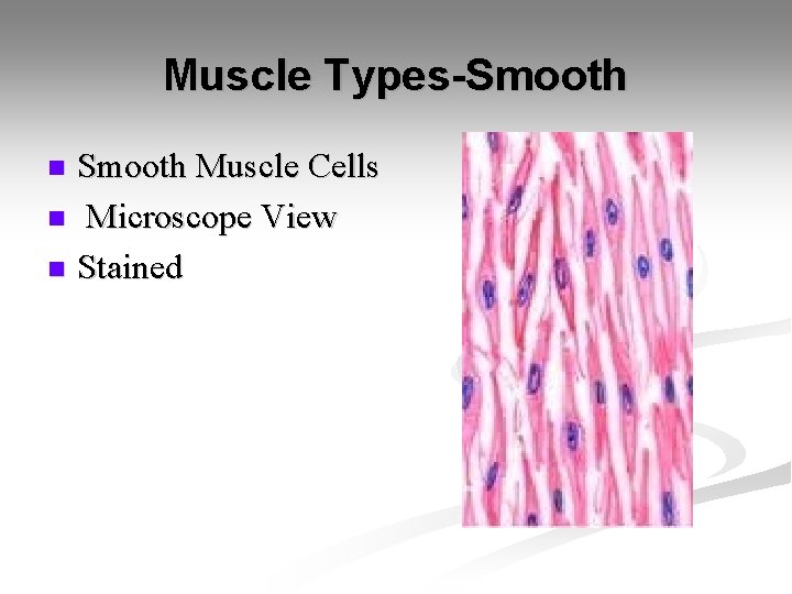 Muscle Types-Smooth Muscle Cells n Microscope View n Stained n 