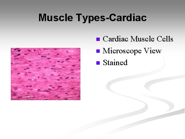 Muscle Types-Cardiac Muscle Cells n Microscope View n Stained n 
