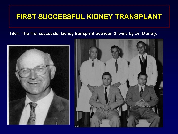 FIRST SUCCESSFUL KIDNEY TRANSPLANT 1954: The first successful kidney transplant between 2 twins by