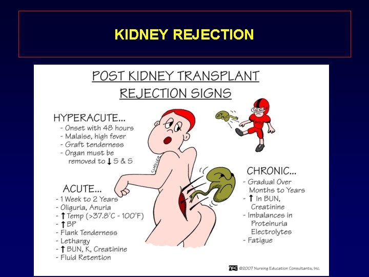 KIDNEY REJECTION 