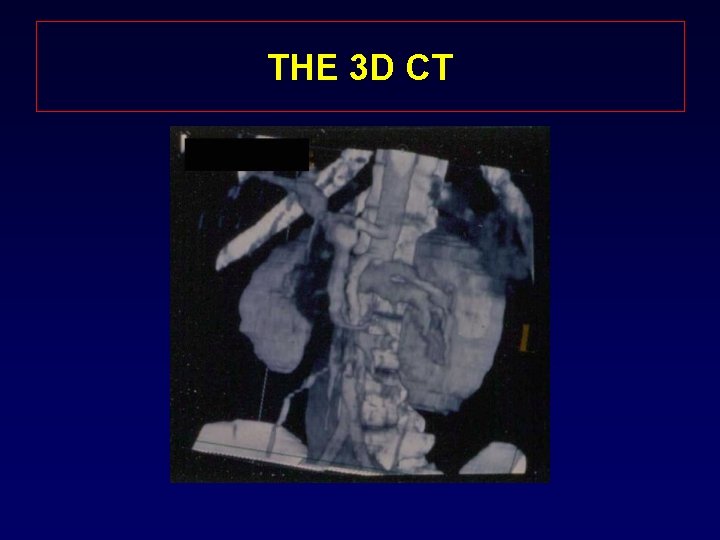 THE 3 D CT 